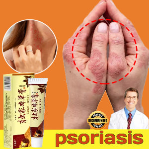 Psoriasis Treatment Herbal Cream🌿