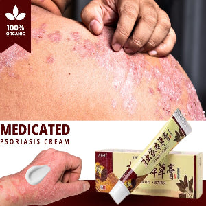 Psoriasis Treatment Herbal Cream