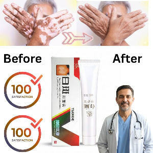 Vitiligo Support Cream – For White Patches / Pigmentation Care