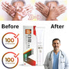Vitiligo Support Cream – For White Patches / Pigmentation Care